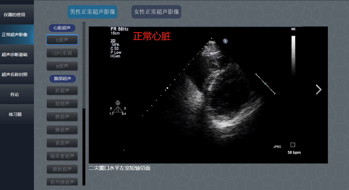 超声诊断思维训练系统